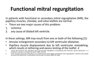 Functional mitral regurgitation
In patients with functional or secondary mitral regurgitation (MR), the
papillary muscles, chordae, and valve leaflets are normal.
• There are two major causes of this problem:
1. ischemia
2. any cause of dilated left ventricle.
In these settings, MR may result from one or both of the following [1]:
• Annular enlargement secondary to left ventricular dilatation
• Papillary muscle displacement due to left ventricular remodeling,
which results in tethering and excess tenting of the leaflet .2
1. Trichon BH, O'Connor CM. Secondary mitral and tricuspid regurgitation accompanying left ventricular systolic dysfunction: is it
important, and how is it treated? Am Heart J 2002; 144:373.
2. Yiu SF, Enriquez-Sarano M, Tribouilloy C, et al. Determinants of the degree of functional mitral regurgitation in patients with systolic
left ventricular dysfunction: A quantitative clinical study. Circulation 2000; 102:1400.
 