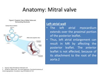 Anatomy: Mitral valve
1. Figure2: http://emedicine.medscape.com
2. Perloff JK, Roberts WC. The mitral apparatus. Functional anatomy of
mitral regurgitation. Circulation. Aug 1972;46(2):227-39.
Left atrial wall
• The left atrial myocardium
extends over the proximal portion
of the posterior leaflet.
• Thus, left atrial enlargement can
result in MR by affecting the
posterior leaflet. The anterior
leaflet is not affected, because of
its attachment to the root of the
aorta.2
 
