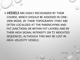 12-01-2020 14
• VESSELS ARE EASILY RECOGNIZED BY THEIR
COURSE, WHICH SHOULD BE ASSESSED IN CINE-
VIEW MODE, BY THEIR TOPOGRAPHY (THEY ARE
OFTEN LOCALIZED AT THE PARENCHYMA AND
FAT JUNCTIONS OR WITHIN FAT LAYERS) AND BY
THEIR HIGH SIGNAL INTENSITY ON T2 WEIGHTED
SEQUENCES, ALTHOUGH THIS MAY BE LOST IN
HIGH-VELOCITY VESSELS
 