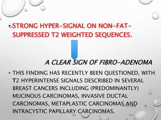 12-01-2020 31
• STRONG HYPER-SIGNAL ON NON-FAT-
SUPPRESSED T2 WEIGHTED SEQUENCES.
A CLEAR SIGN OF FIBRO-ADENOMA
• THIS FINDING HAS RECENTLY BEEN QUESTIONED, WITH
T2 HYPERINTENSE SIGNALS DESCRIBED IN SEVERAL
BREAST CANCERS INCLUDING (PREDOMINANTLY)
MUCINOUS CARCINOMAS, INVASIVE DUCTAL
CARCINOMAS, METAPLASTIC CARCINOMAS AND
INTRACYSTIC PAPILLARY CARCINOMAS.
 