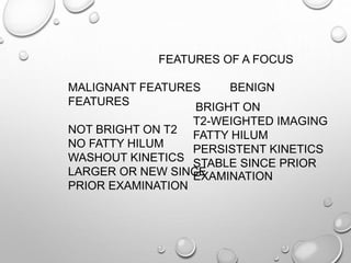 FEATURES OF A FOCUS
MALIGNANT FEATURES BENIGN
FEATURES
NOT BRIGHT ON T2
NO FATTY HILUM
WASHOUT KINETICS
LARGER OR NEW SINCE
PRIOR EXAMINATION
BRIGHT ON
T2-WEIGHTED IMAGING
FATTY HILUM
PERSISTENT KINETICS
STABLE SINCE PRIOR
EXAMINATION
 