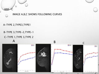 A B C
IMAGE A,B,C SHOWS FOLLOWING CURVES
A-TYPE 2,TYPE3,TYPE1
B-TYPE 3,TYPE-2,TYPE-1
C-TYPE 1,TYPE 3,TYPE 2
ANS -C
 