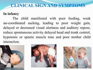 CLINICAL SIGN AND SYMPTOMS
In infancy
The child manifested with poor feeding, weak
un-coordinated sucking, leading to poor weight gain,
delayed or decreased visual alertness and auditory repose,
reduce spontaneous activity delayed head and trunk control,
hypotonic or spastic muscle tone and poor mother child
interaction.
 