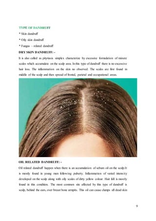 9
* Skin dandruff
* Oily skin dandruff
* Fungus – related dandruff
DRY SKIN DANDRUFF: -
It is also called as pityriasis simplex characterize by excessive formulation of minute
scales which accumulate on the scalp area. In this type of dandruff there is no excessive
hair loss. The inflammation on the skin no observed. The scales are first found in
middle of the scalp and then spread of frontal, parietal and occupational areas.
OIL RELATED DANDRUFF: -
Oil related dandruff happen when there is an accumulation of sebum oil on the scalp.It
is mostly found in young men following puberty. Inflammation of varied intensity
developed on the scalp along with oily scales of dirty yellow colour. Hair fall is mostly
found in this condition. The most common site affected by this type of dandruff is
scalp, behind the ears, over breast bone armpits. This oil can cause clumps all dead skin
 