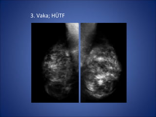 3. Vaka; HÜTF
 