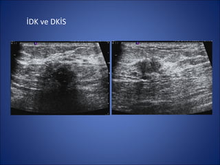 İDK ve DKİS
 