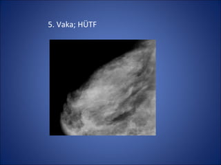5. Vaka; HÜTF
 