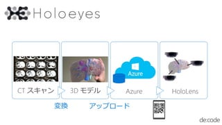 CT  3D ǥ Azure HoloLens
Q åץ`
 
