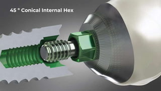 Biohorizons Implant System Overview | PPTX