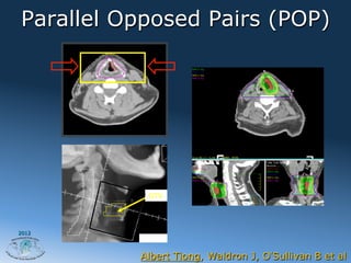 Parallel Opposed Pairs (POP)




           GTV




2012




          Albert Tiong, Waldron J, O Sullivan B et al
 