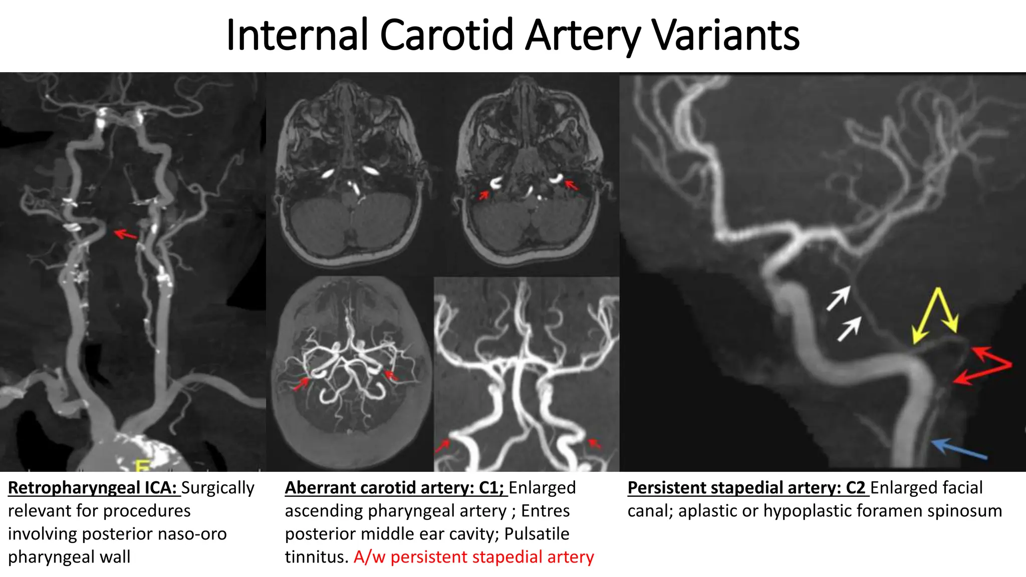 Magnetic Resonance Angiography of head and neck.pptx