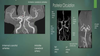 Magnetic Resonance Angiography of head and neck.pptx