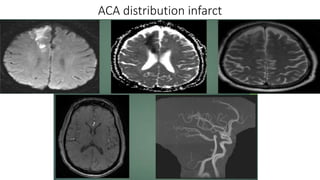 Magnetic Resonance Angiography of head and neck.pptx