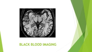 BLACK BLOOD IMAGING
 