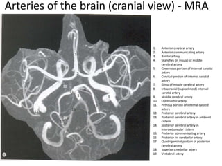 Arteries of the brain (cranial view) - MRA
1. Anterior cerebral artery
2. Anterior communicating artery
3. Basilar artery
4. branches (in insula) of middle
cerebral artery
5. Cavernous portion of internal carotid
artery
6. Cervical portion of internal carotid
artery
7. Genu of middle cerebral artery
8. Intracranial (supraclinoid) internal
carotid artery
9. Middle cerebral artery
10. Ophthalmic artery
11. Petrous portion of internal carotid
artery
12. Posterior cerebral artery
13. Posterior cerebral artery in ambient
cistern
14. posterior cerebral artery in
interpeduncular cistern
15. Posterior communicating artery
16. Posterior inf cerebellar artery.
17. Quadrigeminal portion of posterior
cerebral artery
18. Superior cerebellar artery
19. Vertebral artery
 