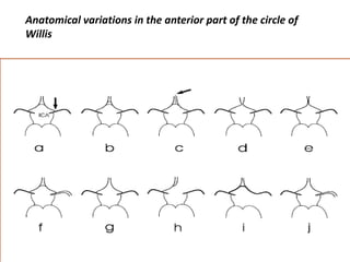 Anatomical variations in the anterior part of the circle of
Willis
 