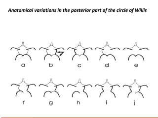 Anatomical variations in the posterior part of the circle of Willis
 