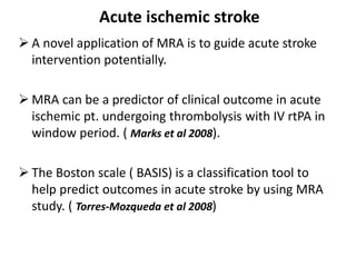 Acute ischemic stroke
 A novel application of MRA is to guide acute stroke
intervention potentially.
 MRA can be a predictor of clinical outcome in acute
ischemic pt. undergoing thrombolysis with IV rtPA in
window period. ( Marks et al 2008).
 The Boston scale ( BASIS) is a classification tool to
help predict outcomes in acute stroke by using MRA
study. ( Torres-Mozqueda et al 2008)
 