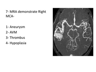 7- MRA demonstrate Right
MCA-
1- Aneurysm
2- AVM
3- Thrombus
4- Hypoplasia
 
