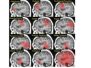 magnetic resonance angiography