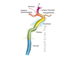 magnetic resonance angiography
