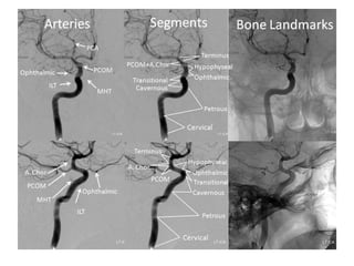magnetic resonance angiography