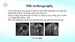 MR Arthrography
ü Là kỹ thuật chụp cộng hưởng từ khớp có tiêm chất tương phản vào trong bao
khớp (direct) hoặc vào đường mạch máu (indirect)
ü Được sử dụng trong đánh giá các khớp vai, khuỷu, cổ tay, háng, gối, cổ chân
và cả khớp thái dương – hàm.
ü Đây là kỹ thuật khảo sát tổn thương khớp hiệu quả, phổ biến trên thế giới.
T1FS in MRA
 