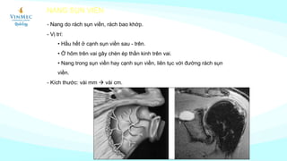 MR arthrography khớp vai | PDF