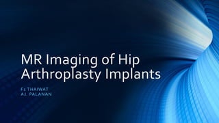 F1 THAIWAT
AJ. PALANAN
MR Imaging of Hip
Arthroplasty Implants
 
