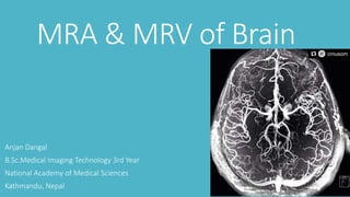 MRA & MRV of Brain
Anjan Dangal
B.Sc.Medical Imaging Technology 3rd Year
National Academy of Medical Sciences
Kathmandu, Nepal
 