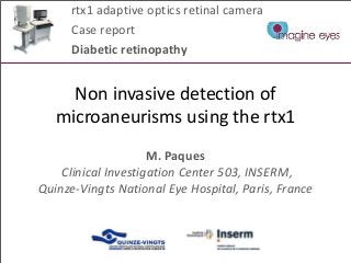 Non invasive detection of
microaneurisms using the rtx1
M. Paques
Clinical Investigation Center 503, INSERM,
Quinze-Vingts National Eye Hospital, Paris, France
rtx1 adaptive optics retinal camera
Case report
Diabetic retinopathy
 