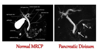 Mrcp Example Image Normal MRCP imaging of radiology mri technique see | PPTX