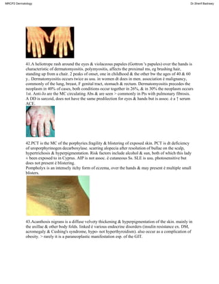 41.A heliotrope rash around the eyes & violaceous papules (Gottron 's papules) over the hands is
characteristic of dermatomyositis. polymyositis, affects the proximal ms, eg brushing hair,
standing up from a chair. 2 peaks of onset, one in childhood & the other bw the ages of 40 & 60
y.. Dermatomyositis occurs twice as usu. in women dt does in men. association é malignancy,
commonly of the lung, breast, F genital tract, stomach & rectum. Dermatomyositis precedes the
neoplasm in 40% of cases, both conditions occur together in 26%, & in 30% the neoplasm occurs
1st. Anti-Jo are the MC circulating Abs & are seen > commonly in Pts with pulmonary fibrosis.
A DD is sarcoid, does not have the same predilection for eyes & hands but is assoc. é a ↑ serum
ACE.
42.PCT is the MC of the porphyries.fragility & blistering of exposed skin. PCT is dt deficiency
of uroporphyrinogen decarboxylase. scarring alopecia after resolution of bullae on the scalp,
hypertrichosis & hyperpigmentation. Risk factors include alcohol & sun, both of which this lady
± been exposed to in Cyprus. AIP is not assoc. é cutaneous Ss. SLE is usu. photosensitive but
does not present é blistering.
Pompholyx is an intensely itchy form of eczema, over the hands & may present é multiple small
blisters.
43.Acanthosis nigrans is a diffuse velvety thickening & hyperpigmentation of the skin. mainly in
the axillae & other body folds. linked é various endocrine disorders (insulin resistance ex. DM,
acromegaly & Cushing's syndrome, hypo- not hyperthyroidism). also occur as a complication of
obesity. > rarely it is a paraneoplastic manifestation esp. of the GIT.
MRCP2 Dermatology Dr.Sherif Badrawy
 