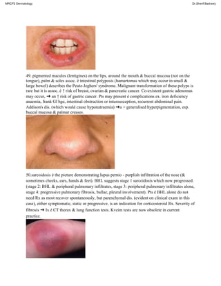 49. pigmented macules (lentigines) on the lips, around the mouth & buccal mucosa (not on the
tongue), palm & soles assoc. é intestinal polyposis (hamartomas which may occur in small &
large bowel) describes the Peutz-Jeghers' syndrome. Malignant transformation of these polyps is
rare but it is assoc. é ↑ risk of breast, ovarian & pancreatic cancer. Co-existent gastric adenomas
may occur, ➜ an ↑ risk of gastric cancer. Pts may present é complications ex. iron deficiency
anaemia, frank Gl hge, intestinal obstruction or intussusception, recurrent abdominal pain.
Addison's dis. (which would cause hyponatraemia) ➜a > generalised hyperpigmentation, esp.
buccal mucosa & palmar creases.
50.sarcoidosis é the picture demonstrating lupus pernio - purplish infiltration of the nose (&
sometimes cheeks, ears, hands & feet). BHL suggests stage 1 sarcoidosis which now progressed.
(stage 2: BHL & peripheral pulmonary infiltrates, stage 3: peripheral pulmonary infiltrates alone,
stage 4: progressive pulmonary fibrosis, bullae, pleural involvement). Pts é BHL alone do not
need Rx as most recover spontaneously, but parenchymal dis. (evident on clinical exam in this
case), either symptomatic, static or progressive, is an indication for corticosteroid Rx. Severity of
fibrosis ➜ Ix é CT thorax & lung function tests. Kveim tests are now obsolete in current
practice.
MRCP2 Dermatology Dr.Sherif Badrawy
 