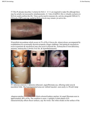 57.This Pt already describes 3 criteria for SLE (> 4/ 11 are required to make Dx although these
may be serially not necessarily simultaneously). A ↑ titre of dsDNA Abs is virtually exclusive to
SLE & would confirm this Dx. Titres can be used to measure dis. activity alongside ESR & C3,
C4 levels. CRP is not esp. useful in SLE as levels may remain ↓in active dis..
58.pretibial myxoedema which occurs in 5% of Pts é Graves dis. almost always accompanied by
exophthalmos & occasionally thyroid acropachy (finger clubbing). Nail pitting & onycholysis
occur in psoriasis & onycholysis may also occur in thyroid dis., koilonychia in iron-deficiency
anaemia, leukonychia é chronic liver dis. & hypoalbuminaemia
59. tuberous sclerosis é 'adenoma sebaceum', angiofibromata usu. affecting malar area &
nasolabial folds. The hypopigmented areas are 'ashleaf macules', seen easily é a Wood's lamp
,shagreen patches (flesh·coloured leathery patches} & ungal fibromata seen in
approximately 40% of Pts. The condition is assoc. é epilepsy Lichen planus (LP)
characteristically affects flexor surfaces, esp. the wrists. fine white streaks on the surface of the
MRCP2 Dermatology Dr.Sherif Badrawy
 