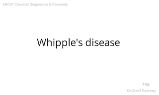 Whipple's disease
74a
MRCP Classical Diagnostics & Keywords
Dr.Sherif Badrawy
 