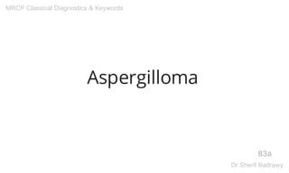Aspergilloma
83a
MRCP Classical Diagnostics & Keywords
Dr.Sherif Badrawy
 