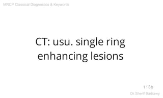 CT: usu. single ring
enhancing lesions
113b
MRCP Classical Diagnostics & Keywords
Dr.Sherif Badrawy
 