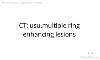 CT: usu.multiple ring
enhancing lesions
114b
MRCP Classical Diagnostics & Keywords
Dr.Sherif Badrawy
 