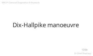 Dix-Hallpike manoeuvre
125b
MRCP Classical Diagnostics & Keywords
Dr.Sherif Badrawy
 