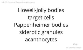 Howell-Jolly bodies
target cells
Pappenheimer bodies
siderotic granules
acanthocytes
126b
MRCP Classical Diagnostics & Keywords
Dr.Sherif Badrawy
 