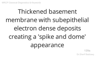 Thickened basement
membrane with subepithelial
electron dense deposits
creating a 'spike and dome'
appearance
129a
MRCP Classical Diagnostics & Keywords
Dr.Sherif Badrawy
 