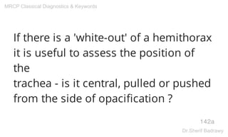 If there is a 'white-out' of a hemithorax
it is useful to assess the position of
the
trachea - is it central, pulled or pushed
from the side of opacification ?
142a
MRCP Classical Diagnostics & Keywords
Dr.Sherif Badrawy
 