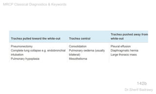 142b
MRCP Classical Diagnostics & Keywords
Dr.Sherif Badrawy
 