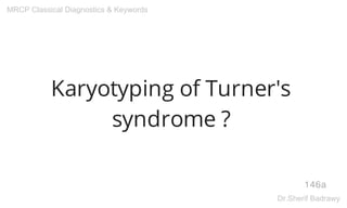 Karyotyping of Turner's
syndrome ?
146a
MRCP Classical Diagnostics & Keywords
Dr.Sherif Badrawy
 