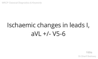 Ischaemic changes in leads I,
aVL +/- V5-6
169a
MRCP Classical Diagnostics & Keywords
Dr.Sherif Badrawy
 
