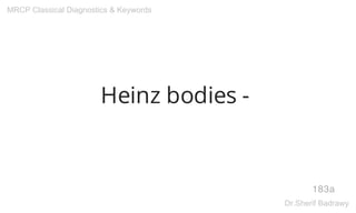 Heinz bodies -
183a
MRCP Classical Diagnostics & Keywords
Dr.Sherif Badrawy
 