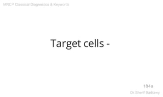 Target cells -
184a
MRCP Classical Diagnostics & Keywords
Dr.Sherif Badrawy
 