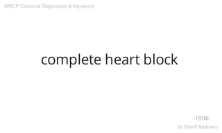 complete heart block
190b
MRCP Classical Diagnostics & Keywords
Dr.Sherif Badrawy
 