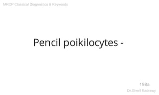 Pencil poikilocytes -
198a
MRCP Classical Diagnostics & Keywords
Dr.Sherif Badrawy
 
